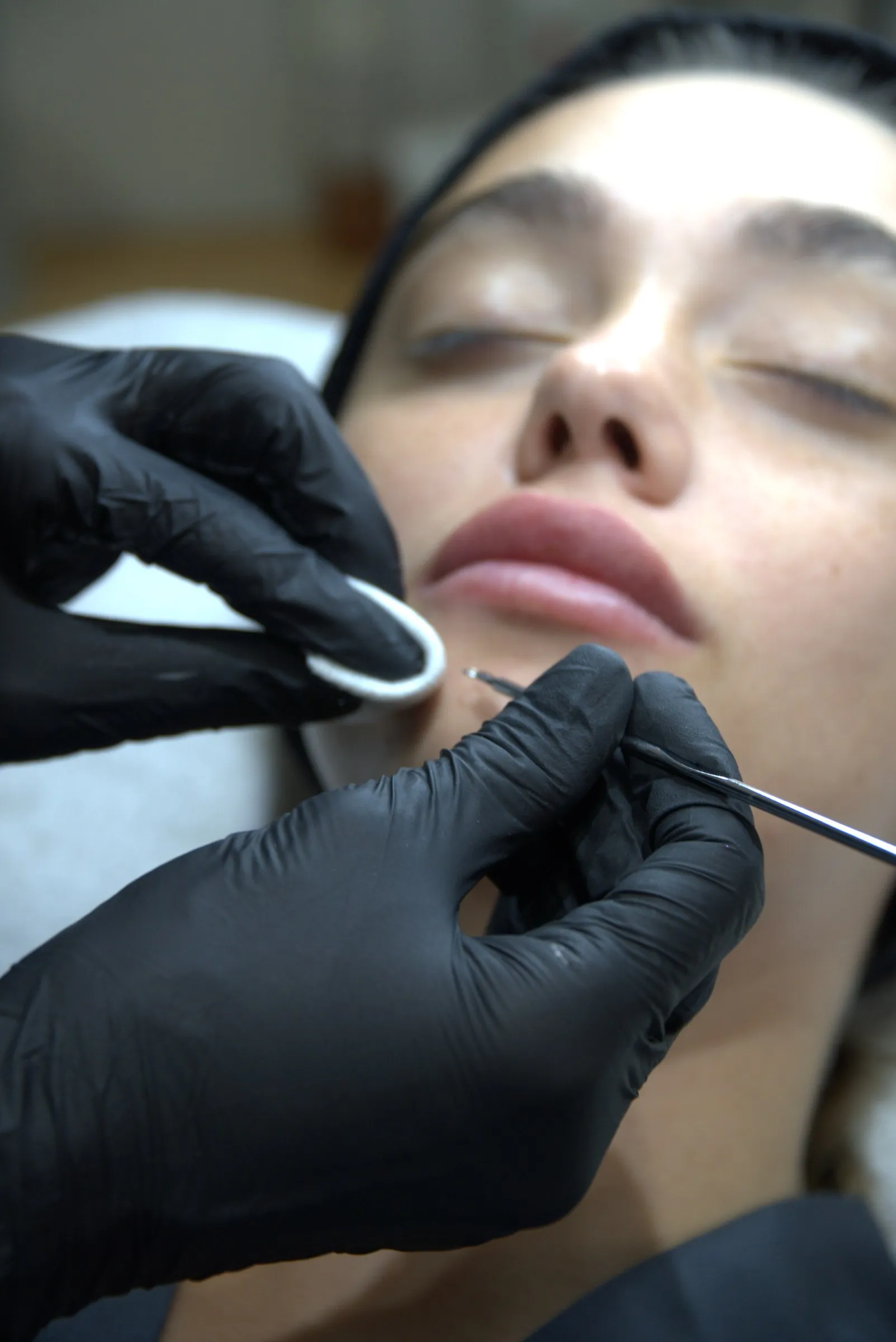 Extracción durante una limpieza facial