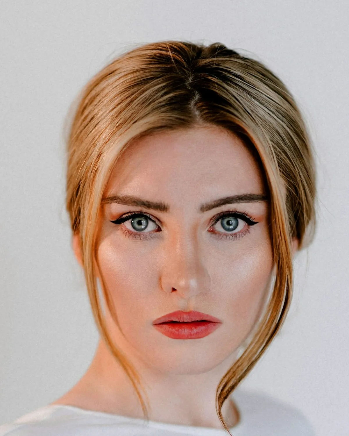 Rostro con las zonas que se tratan con limpieza de cutis, toxina, hilos, rellenos y bioestimuladores